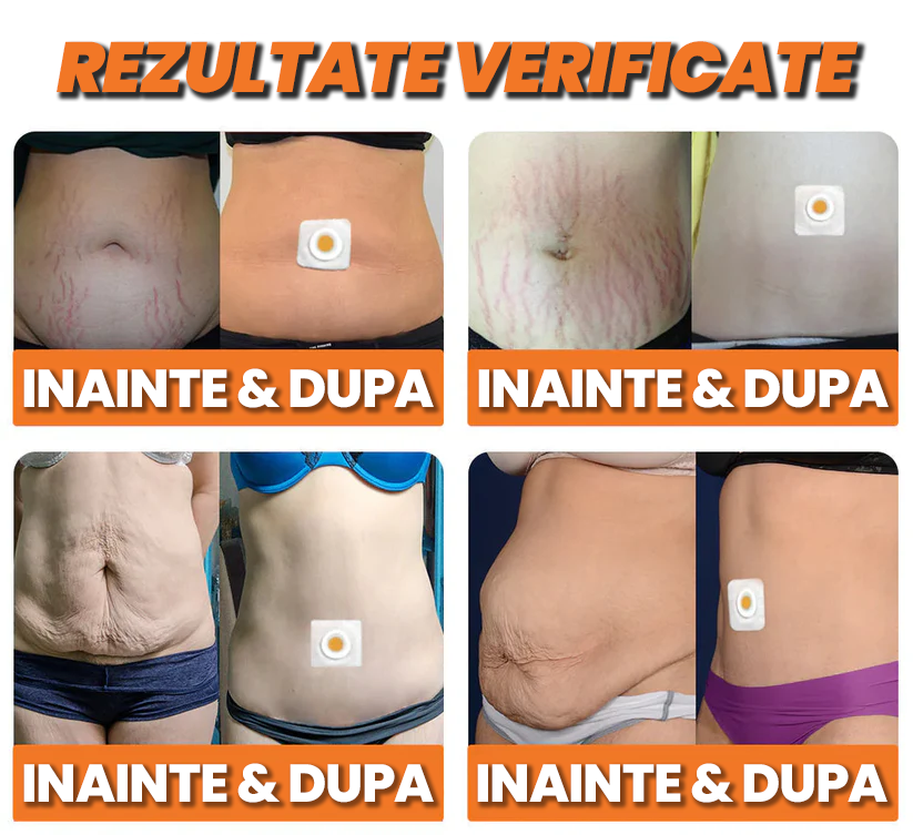 Plasturi Pentru Slabit