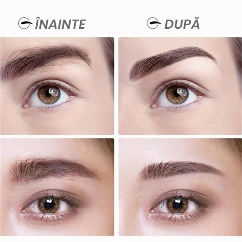 Epilatorul Magic